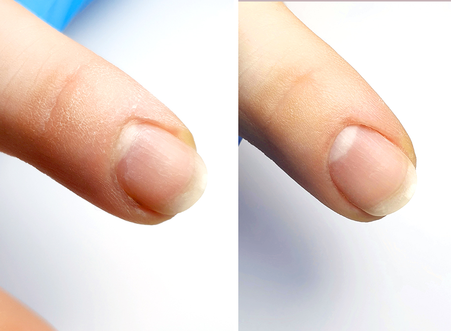 manicure frezarkowy przed i po